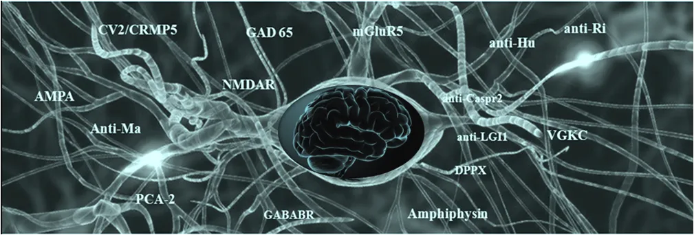 https://e-neurologos.gr/aytoanosi-egkefalitida-aytoanosi-anoi/